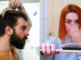Know the best astrological remedies for hair loss